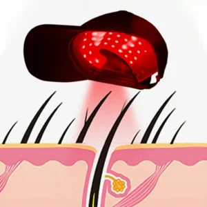 Home Use Red Led Light Hair Growth Therapy Cap For Hair Loss